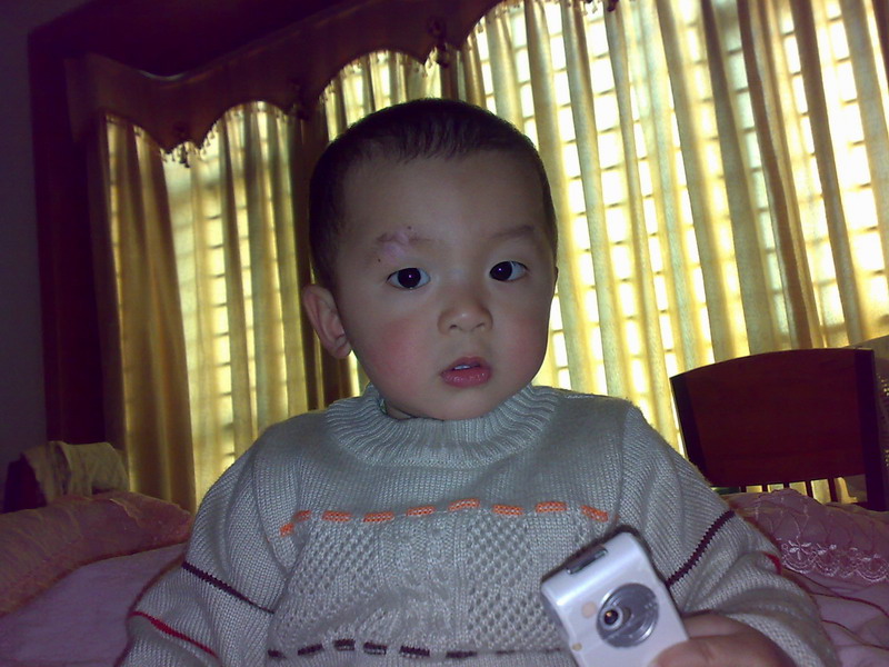 ��ȥ�İ̺ۣ��е���