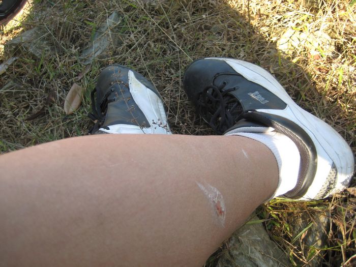 ����и���̤�ݺݵ�ҧȥ��һ��Ƥ,ʹ�಻��